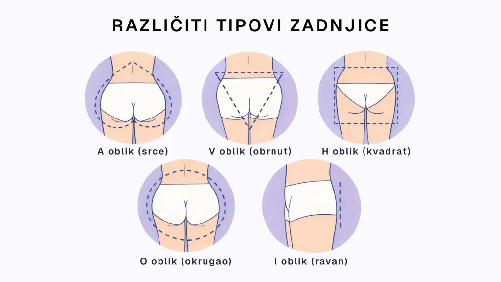 Oblik zadnjice. Šta određuje genetika, a šta može da promeni trening