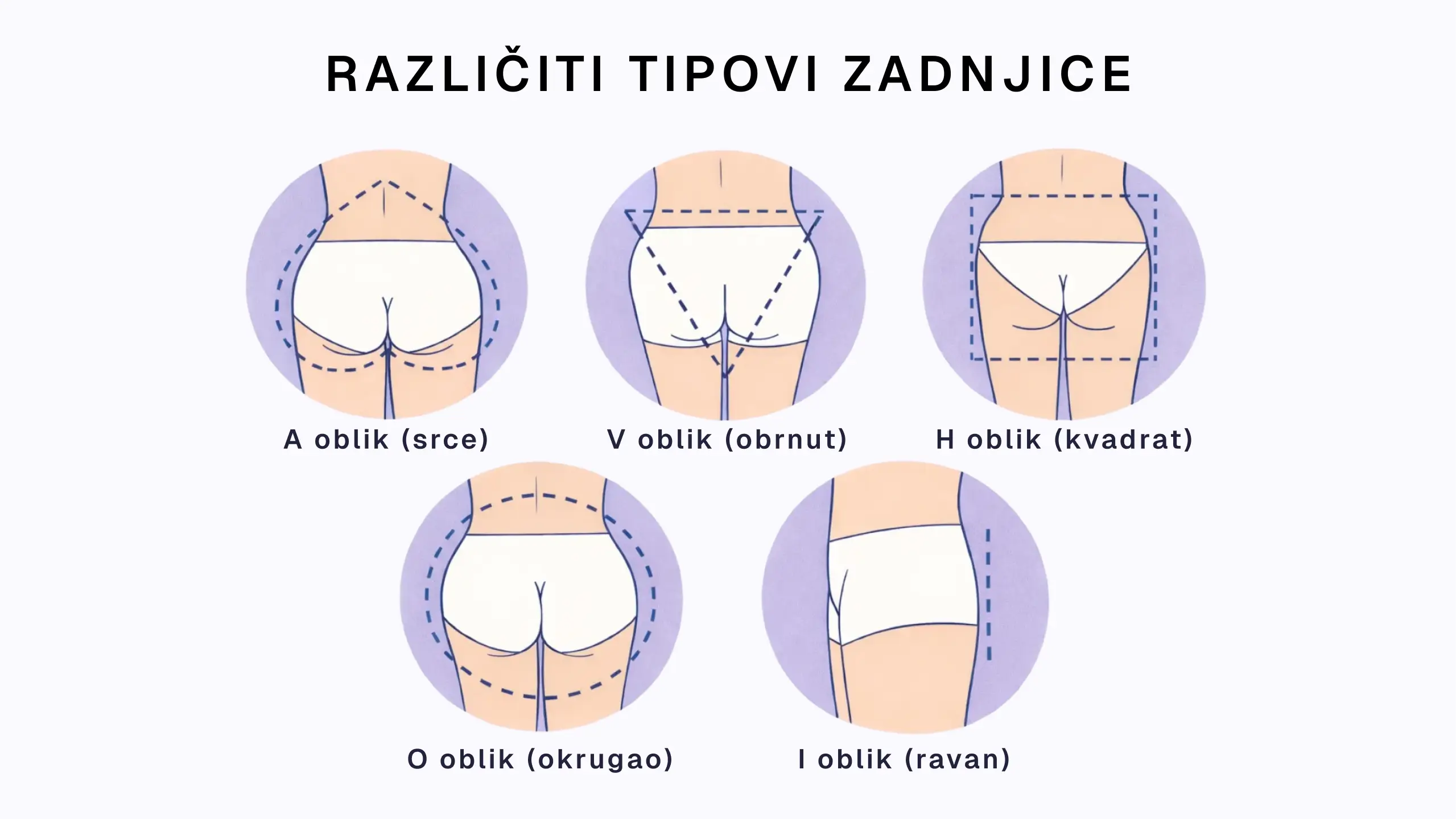 Oblik zadnjice. Šta određuje genetika, a šta može da promeni trening